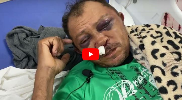 VÍDEO: Agricultor espancado por assaltantes em Cajazeiras teve cano da arma na boca, mas evitou disparo