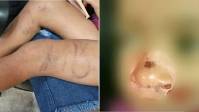 Mãe presa suspeita de espancar filha de cinco anos em Cabedelo responderá processo em liberdade