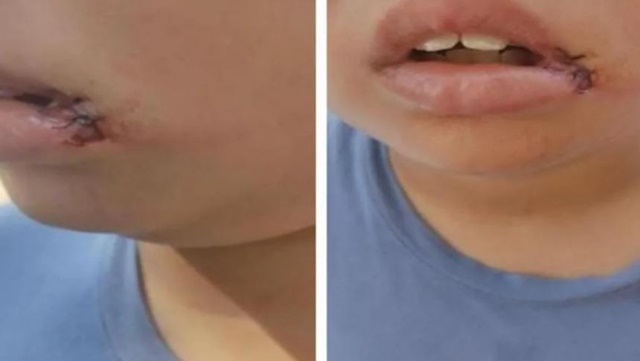 Homem quebra dentes de filho da namorada após se irritar com choro do menino