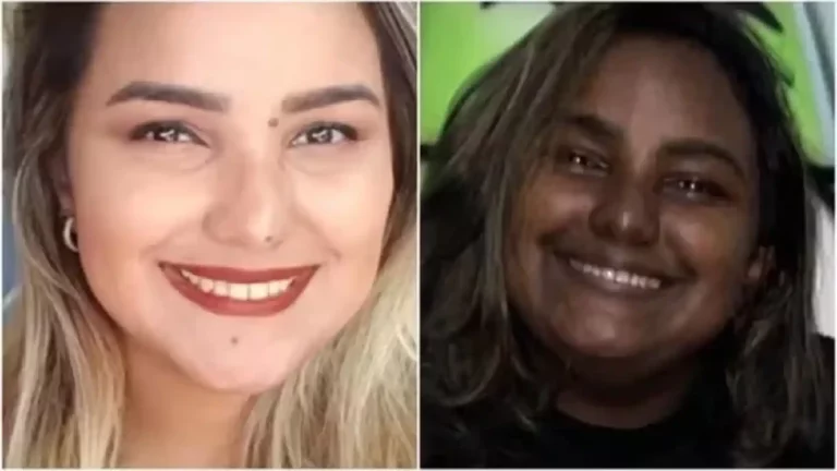 Cearense que mudou cor da pele após doença briga na justiça por tratamento