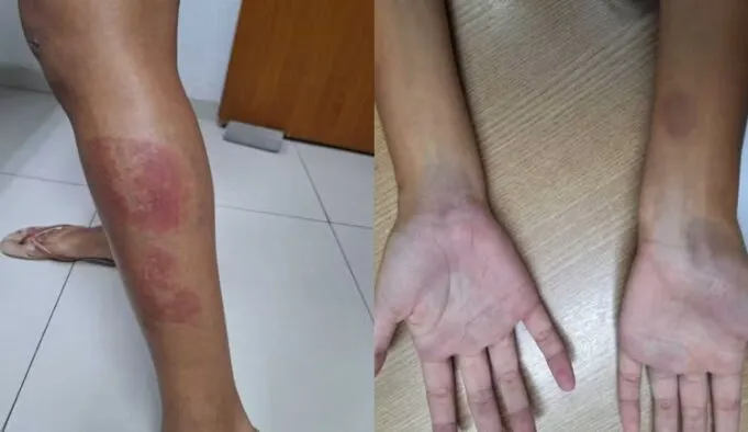Dois irmãos são presos por agredir grávida a pauladas, em Bayeux