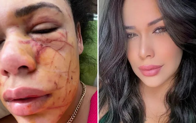 Modelo denuncia que foi agredida por mulheres na porta de boate por causa de cadeira – VEJA O VÍDEO