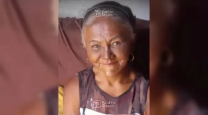 Mulher que teve 30% do corpo queimado em incêndio na cidade de Patos deixa UTI e segue para enfermaria em Campina Grande