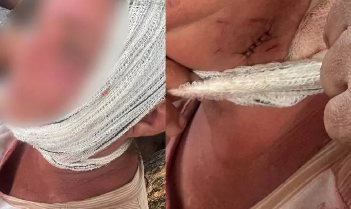 Mulher revela ter sido vítima de tentativa de abuso após ser ferida com golpe de faca no Sertão da Paraíba
