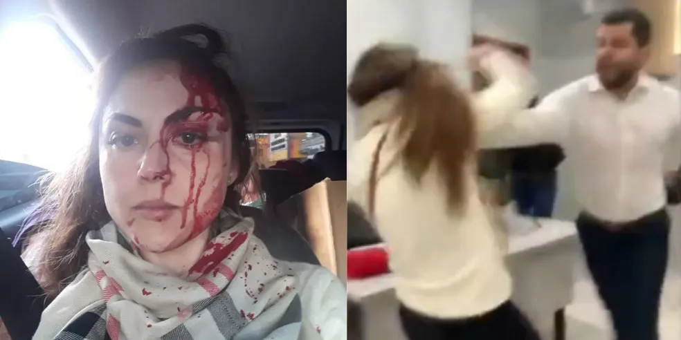Justiça absolve procurador que espancou a chefe durante o trabalho por conta de esquizofrenia paranoide