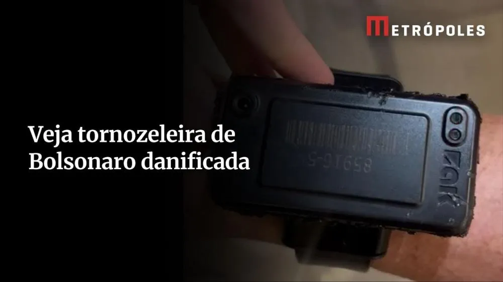 Bolsonaro confessa que queimou tornozeleira com ferro quente e justifica: “Curiosidade”. Vídeo