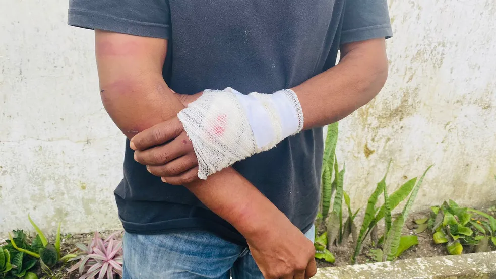 Homem é torturado com marteladas nas mãos por suspeita de roubo, na PB