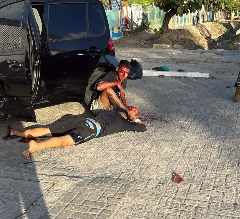 Policial é atropelado e três suspeitos são baleados durante perseguição e troca de tiros, em João Pessoa