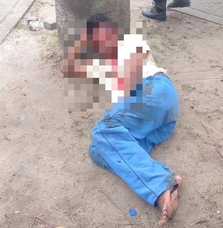 Ataque violento: homem é espancado por cerca de 10 pessoas e tem a cabeça atingida dentro de banheiro em parque de João Pessoa