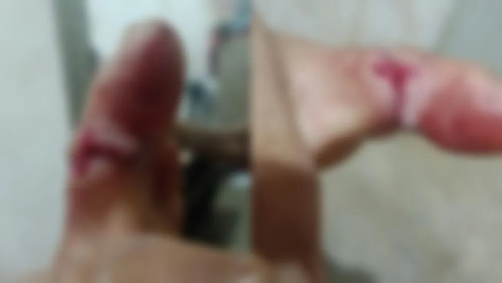 Ciclista é atacado por cães e fica ferido no bairro do Novo Horizonte, em Patos