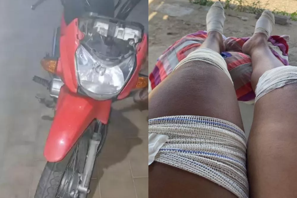 Mulher fica ferida após acidente envolvendo carro de aplicativo no Centro de Patos; motorista fugiu sem prestar socorro