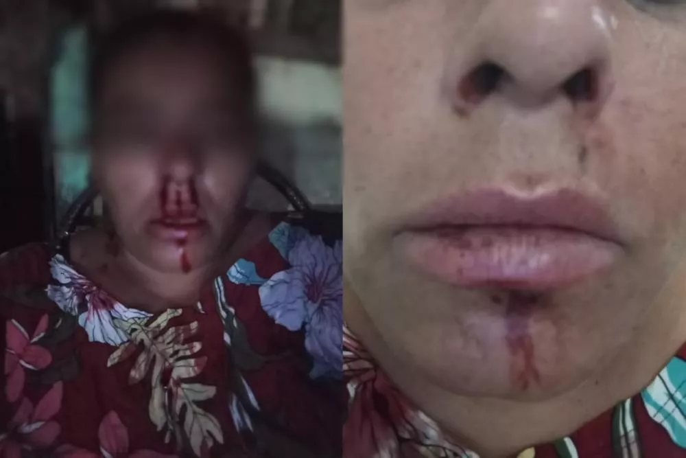 Em Patos, mulher registra boletim de ocorrência na delegacia após ser agredida por primo ao intervir em discussão