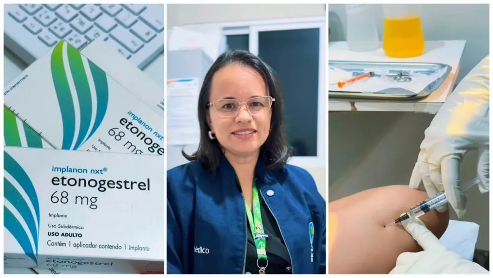 Dia D de Implantes de Implanon beneficia 20 mulheres em São José de Espinharas