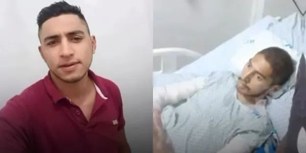 Morre após quase sete meses internado, homem que teve o corpo queimado 70% em Coremas 