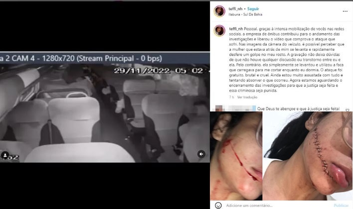 Vídeo mostra momento em que passageira levanta e se aproxima da jovem que teve rosto cortado em ônibus na Bahia; veja