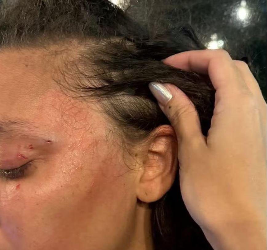 Mulher é agredida por cliente em restaurante ao usar banheiro feminino: 