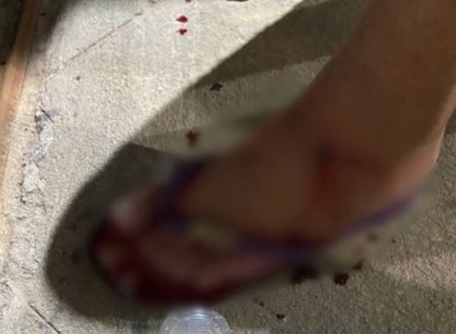 Tentativa de assalto em Patos, deixa jovem de 16 anos ferida por um disparo de arma de fogo.