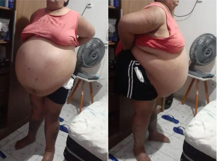 Patoense que está em tratamento de mioma e impossibilitada de trabalhar pede ajuda para conseguir alimentação e produtos de higiene; veja como contribuir